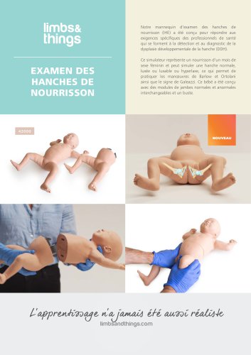 EXAMEN DES HANCHES DE NOURRISSON