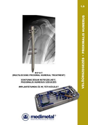 (MPHT) Multilocking Proximal Humeral Treatment nailing