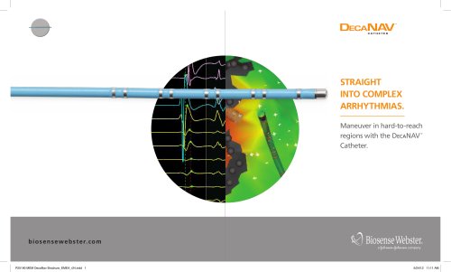 DecaNav? Catheter