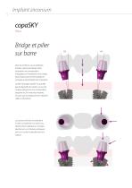 copaSKY – Système d’implant - bredent medical - 12