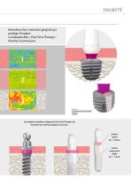 Système d'implants SKY – DNA – Présentation du système - 11