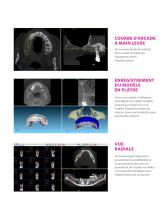 BTI Scan® 4 - Logiciel Planification D'Implantologie Orale - 4