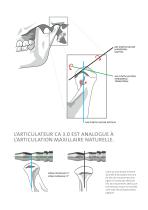 Articulateur CA 3.0 - 5