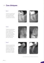 Brochure iRace FR - 6