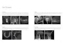 Veraviewepocs 3D R100 - 7