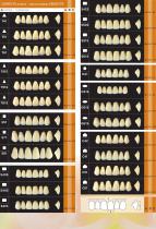 Mould Chart