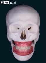 Encart Gingiva-Composites