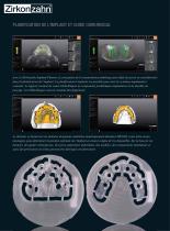 Galerie de cas Implant-Planner Workflow - 2