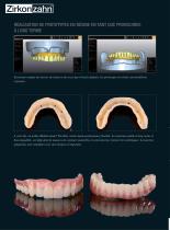 Galerie de cas Implant-Planner Workflow - 5