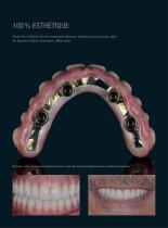 Galerie de cas Prettau® 2 Dispersive® - 3