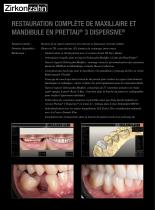 Galerie de cas Prettau® 3 Dispersive® - 2