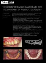 Galerie de cas Prettau® 3 Dispersive® - 2