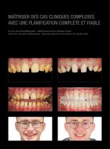 Galerie de cas Prettau® 3 Dispersive® - 3