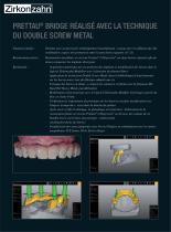 Prettau® Bridge realise avec la technique du double screw metal - 2