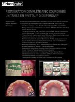 Restauration complete unitaires en Prettau® 3 Dispersive® - 2