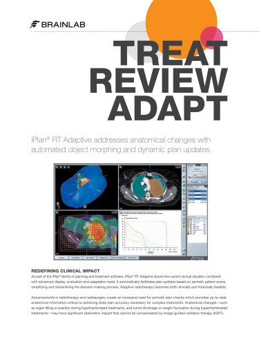 iPlan RT Adaptive