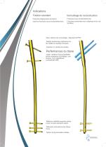 CLOU FEMUR en Titane crée par Sofemed International - 2