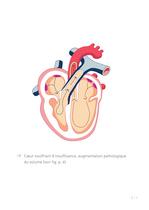 Congestive Heart Failure Therapy System - 9