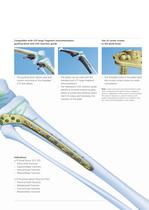 LCP Distal Femur / Promixal Lateral Tibia 4.5 - 5