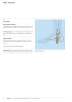 LCP Distal Tibia Plate - Low Bend - 10