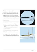 LCP Distal Tibia Plate - Low Bend - 11