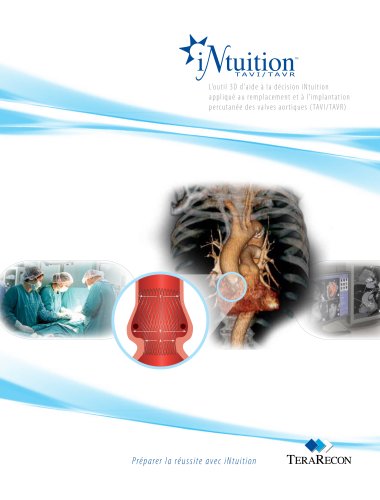 iNtuition TAVI Brochure