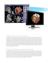 iNtuition TAVI Brochure - 3