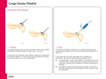 COTYLE A DOUBLE MOBILITE - 4