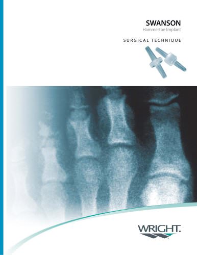 SWANSON® (Weil) Hammertoe Surgical Technique ? SOSTL004