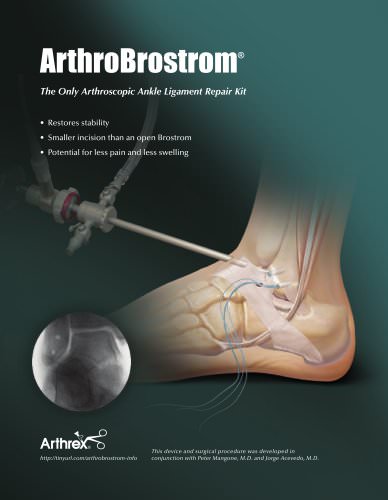 ArthroBrostrom® The Only Arthroscopic Ankle Ligament Repair Kit - LS1-0490-EN