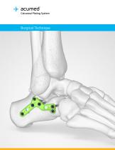 Calcaneal Plating System Surgical Technique (LEX00-05-E)