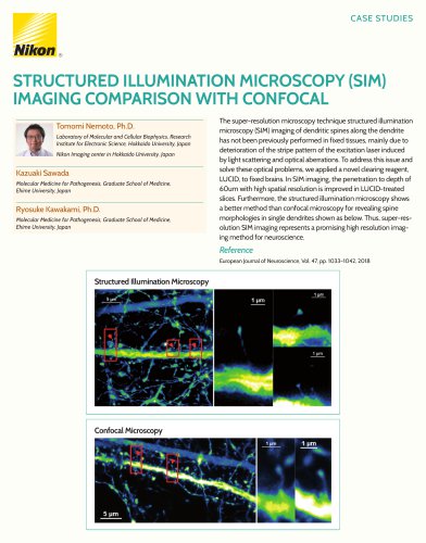 STRUCTURED ILLUMINATION MICROSCOPY (SIM) IMAGING COMPARISON WITH CONFOCAL