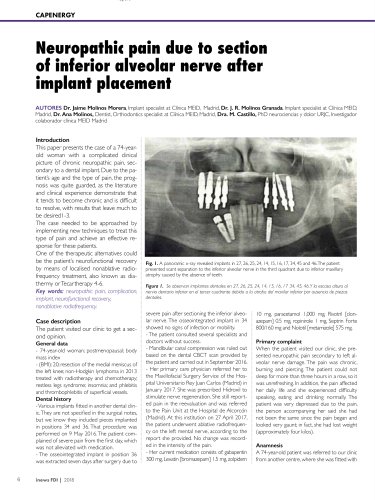 Neuropathic pain due to section of inferior alveolar nerve after implant placement