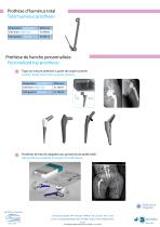 Implants sur mesure - 6