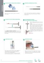 Technique opératoire - Reconstruction de la coiffe des rotateurs - FIXIT®/FIXIT® Knotless-10